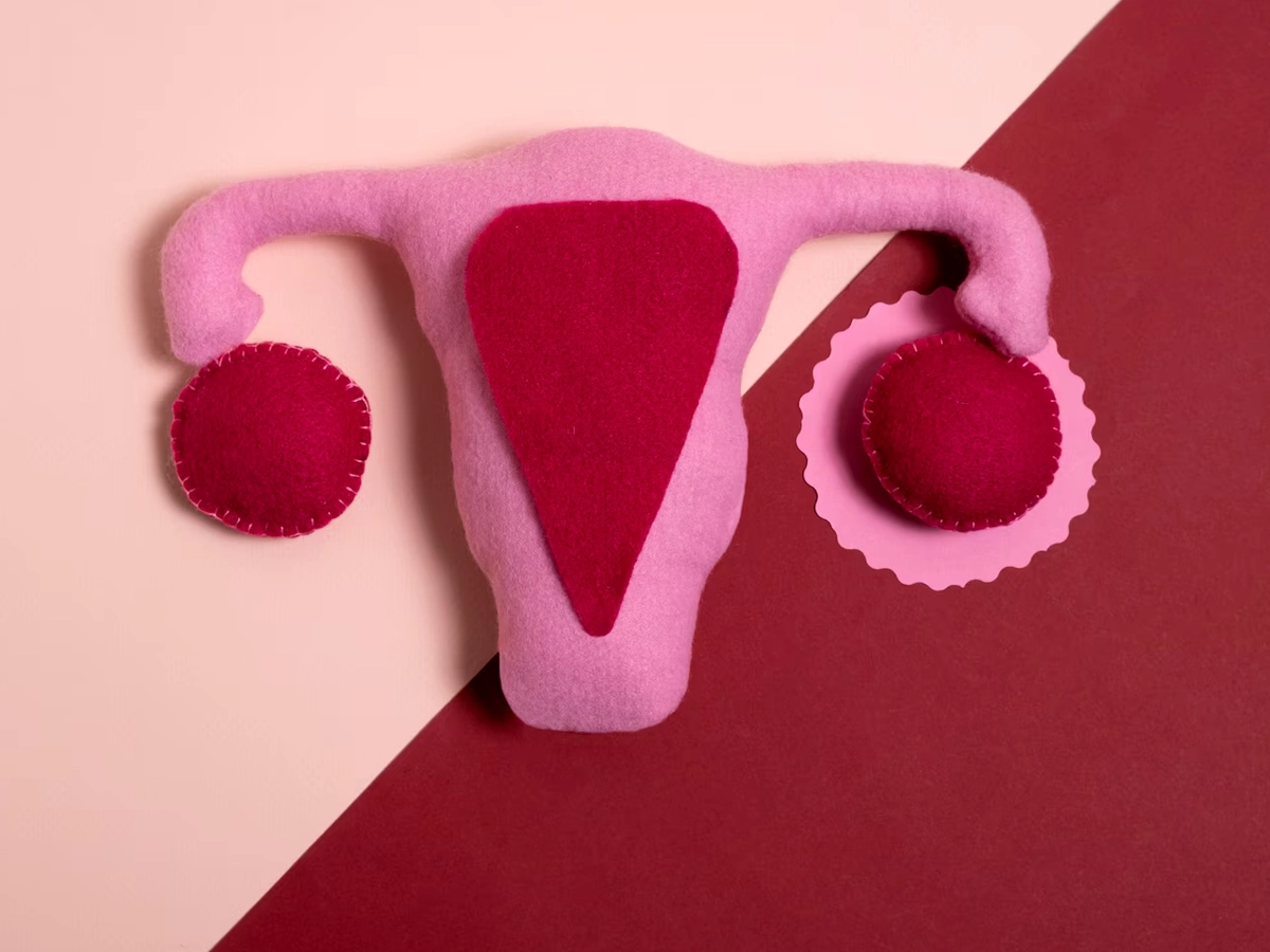 Uterine fibroid management